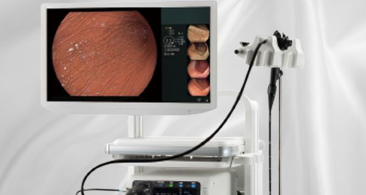 大腸カメラ検査の様子